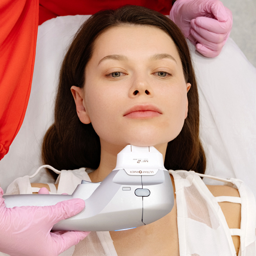 SMAS-лифтинг лица на аппарате Ultraformer