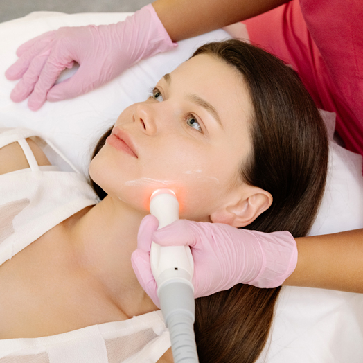 RF-лифтинг лица на аппарате Power Shape